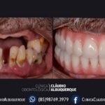 tratamento dentario com Dr. Claudio Albuquerque