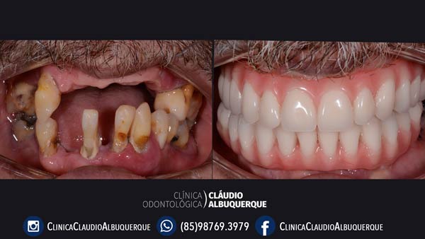 tratamento dentario com Dr. Claudio Albuquerque