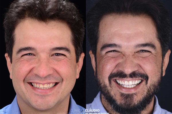 CAso10 CAso10