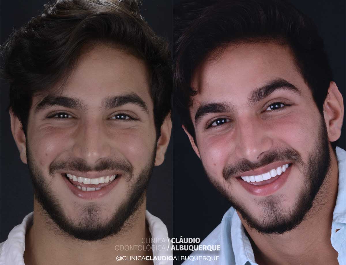 CAso9