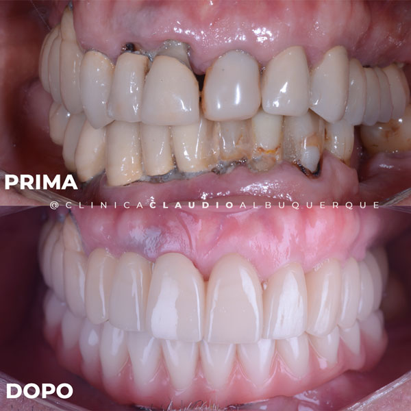 clinica-de-implantes-dentariois-em-fortaleza clinica-de-implantes-dentariois-em-fortaleza